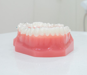 denture