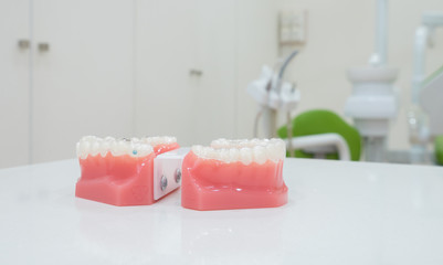 Fototapeta na wymiar denture