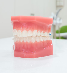 denture
