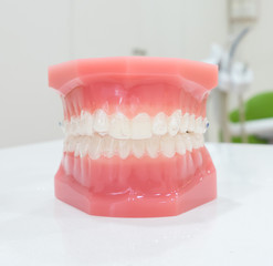 denture
