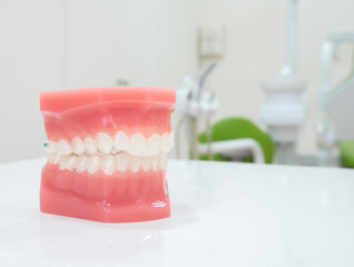 denture
