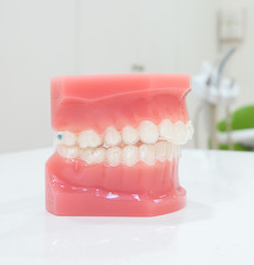 denture
