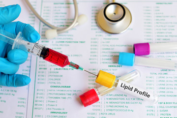 Blood for lipid profile test