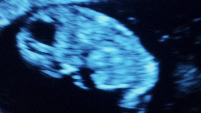 Ultrasound of Baby during Pregnancy with heart beat
