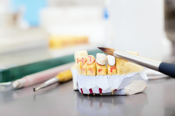 Technical shots of model on a dental prothetic laboratory