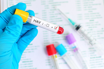 Naklejka premium Hepatitis A virus (HAV) positive