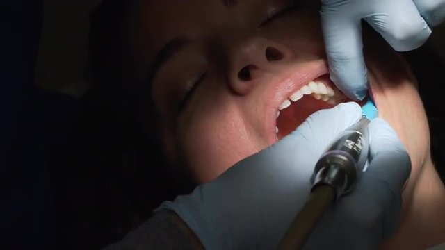 Dentist or dental hygienist carefully examines or cleans teeth of a woman.