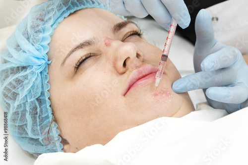 Prep solutions for cosmetic facial injections - porn photo 2020 Bang gang queen swinger