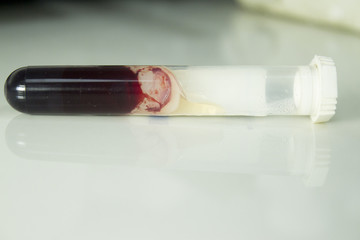 Fototapeta na wymiar Clotted blood