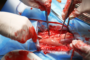 Doctor doing heart operation