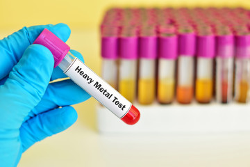 Blood sample for toxic heavy metal test