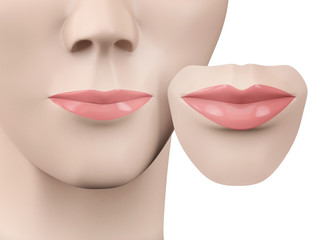 lip augmentation, before and after