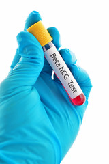Obraz premium Beta hCG test for pregnancy diagnosis