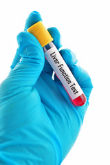 Obraz premium Liver function test