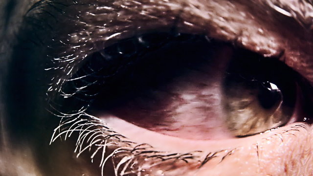 Eye sick evil