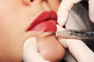 Beauty procedure - Dermatologist performs lips contour plastic with injection of cosmetic filler on...