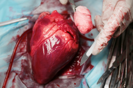 Heart and medical tools on operating table closeup