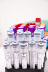 laboratory tubes for blood sampling