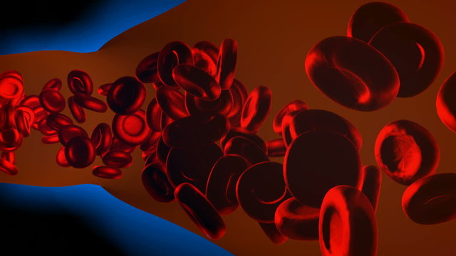 
    Red blood cells. Clogged Artery. Digital Animation, medical concept with a human blood vessel clogged by unhealthy eating, as a health risk for obesity or dieting and nutrition problems 