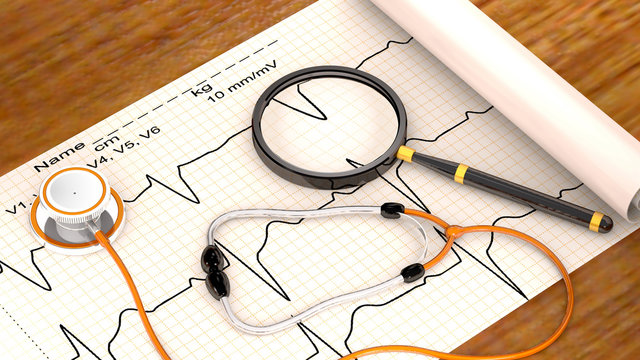 Stethoscope, paper, cardiogram and magnifier are on the table.