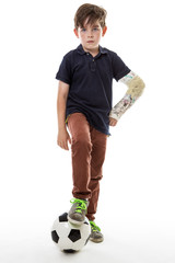 Full length shot of a young boy who cant play football with his friends because he has broken his...