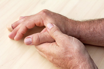 Ein Mann hält sich seine schmerzende Hand