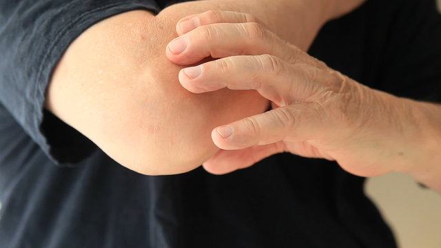 A senior man rubs the area around his elbow.