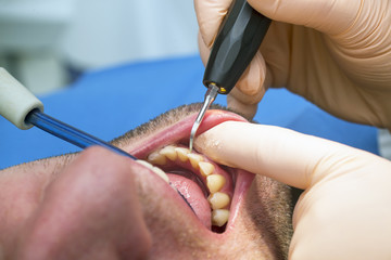 Dentist making patient's teeth hygiene