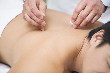 Fototapeta premium Patient receiving acupuncture