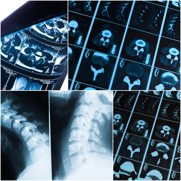 Collage of x-rays