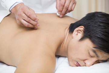 Patient receiving acupuncture