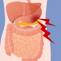 stomach ache and human digestive organs, vector illustration