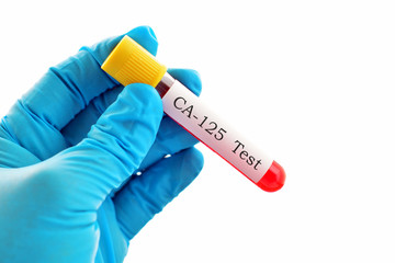 Obraz premium CA-125 test (diagnosis for ovarian cancer)