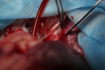 Heart operation closeup