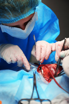 Doctor doing heart operation