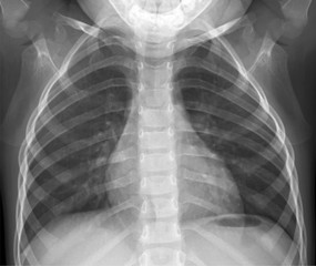 Vector flat icon x-ray of human thorax. Anatomy. 