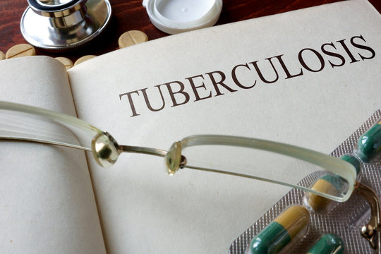 Book With Diagnosis Tuberculosis And Pills. Medical Concept.