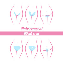 scheme of hair removal bikini area