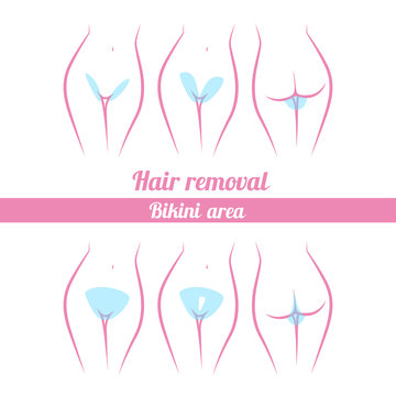 scheme of hair removal bikini area