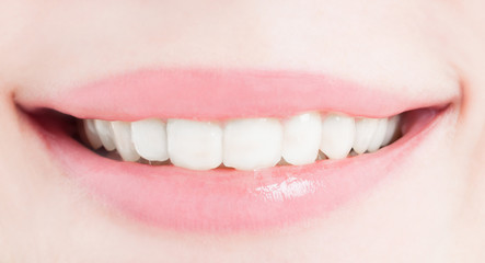 Perfect female smile after bleaching or whitening