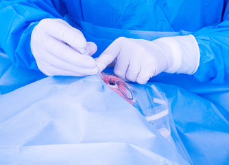 Eye surgery