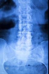 Kneck and spine injury x-ray scan
