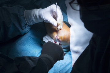 Hospital elbow orthopedics surgery operation