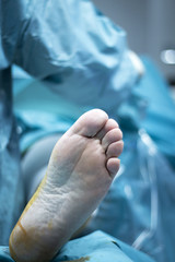 Knee arthroscopy orthopedic surgery operation