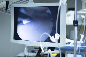 Fototapeta na wymiar Hospital surgery arthroscopy operation screen