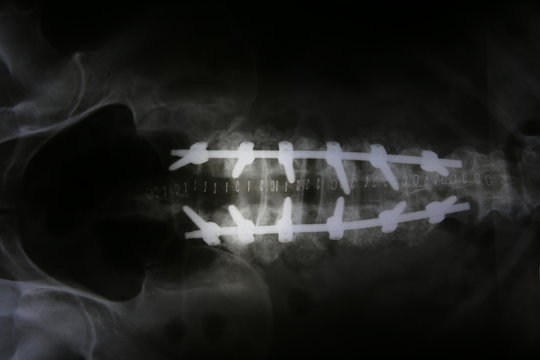 Film x-ray