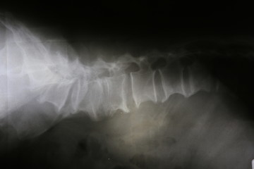 Film x-ray