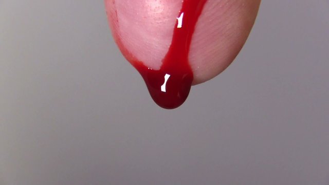 blood drips from the finger