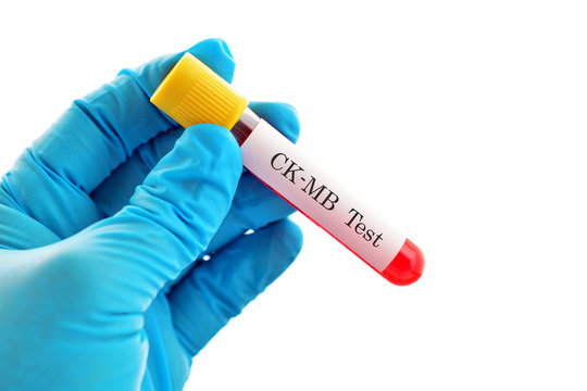 Blood for CK-MB test, diagnosis for heart injury
