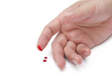 Injured finger with bleeding open cut